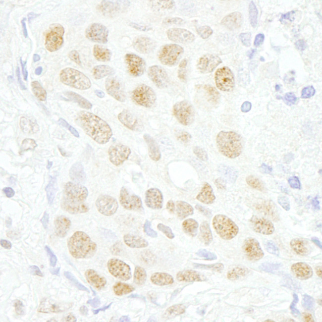 MAZ/SAF-1 Antibody in Immunohistochemistry (Paraffin) (IHC (P))