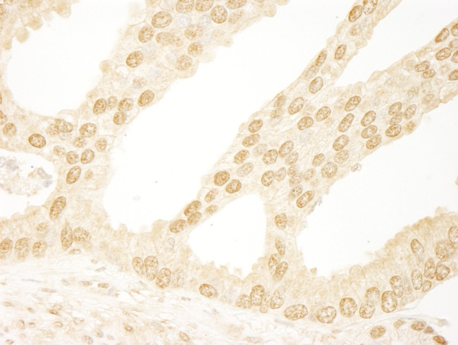 DDX26/DICE1 Antibody in Immunohistochemistry (Paraffin) (IHC (P))