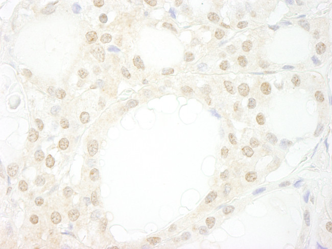 WDR20 Antibody in Immunohistochemistry (Paraffin) (IHC (P))