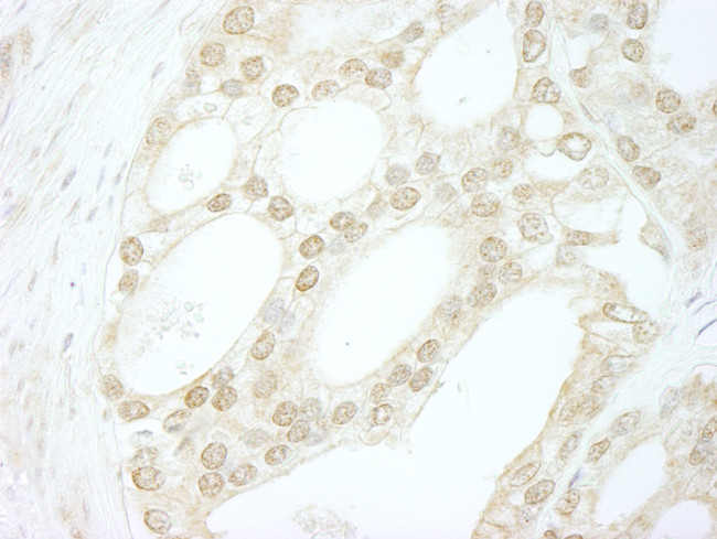 B-Myb Antibody in Immunohistochemistry (Paraffin) (IHC (P))