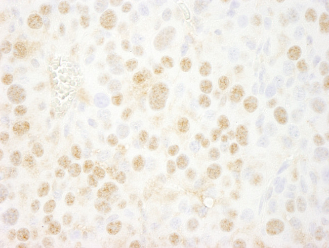 BMI1 Antibody in Immunohistochemistry (Paraffin) (IHC (P))
