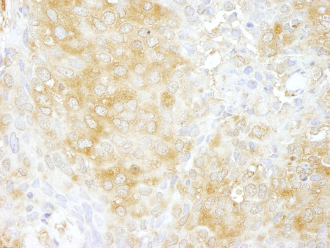 Cdc42GAP Antibody in Immunohistochemistry (Paraffin) (IHC (P))