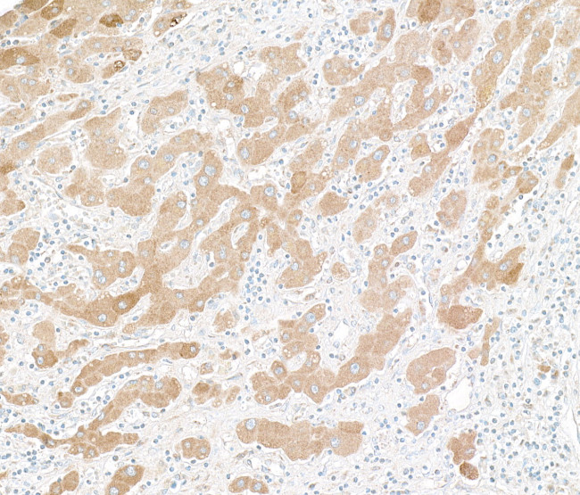 Human C-Reactive Protein (CRP) Antibody in Immunohistochemistry (Paraffin) (IHC (P))