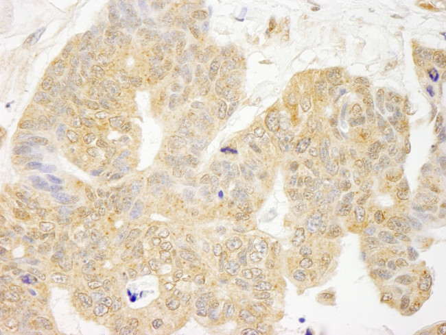 GRB10 Antibody in Immunohistochemistry (Paraffin) (IHC (P))