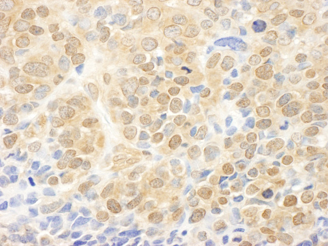 MEK1 Antibody in Immunohistochemistry (Paraffin) (IHC (P))