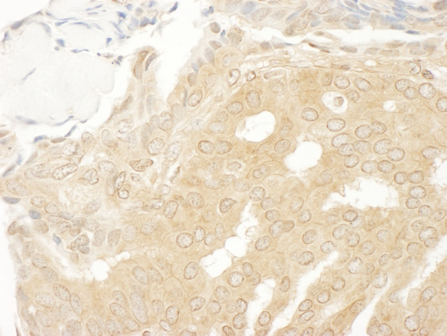 MEK2 Antibody in Immunohistochemistry (Paraffin) (IHC (P))