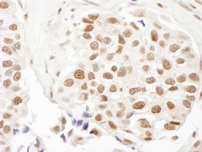 FANCD2 Antibody in Immunohistochemistry (Paraffin) (IHC (P))