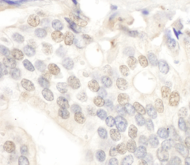 E2F4 Antibody in Immunohistochemistry (Paraffin) (IHC (P))