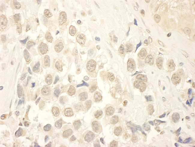HBO Antibody in Immunohistochemistry (Paraffin) (IHC (P))