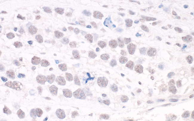 ARID2 Antibody in Immunohistochemistry (Paraffin) (IHC (P))
