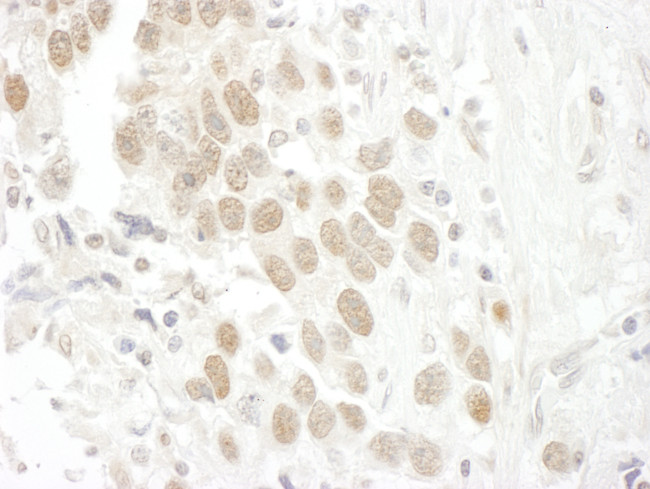 BCCIP Antibody in Immunohistochemistry (Paraffin) (IHC (P))