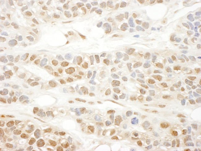 MKL1 Antibody in Immunohistochemistry (Paraffin) (IHC (P))