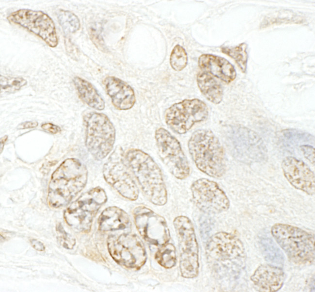 hSET1B Antibody in Immunohistochemistry (Paraffin) (IHC (P))