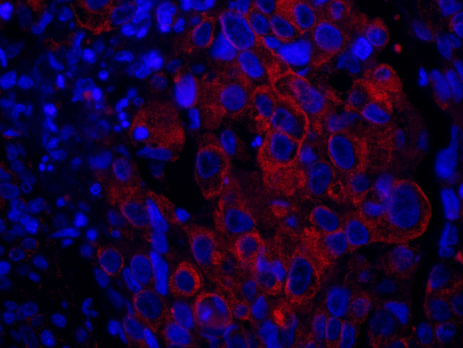 SASH1 Antibody in Immunohistochemistry (Paraffin) (IHC (P))