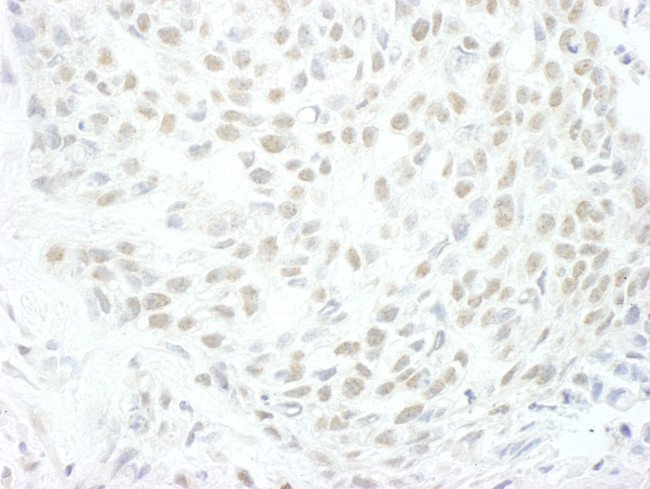 MLLT1 Antibody in Immunohistochemistry (Paraffin) (IHC (P))