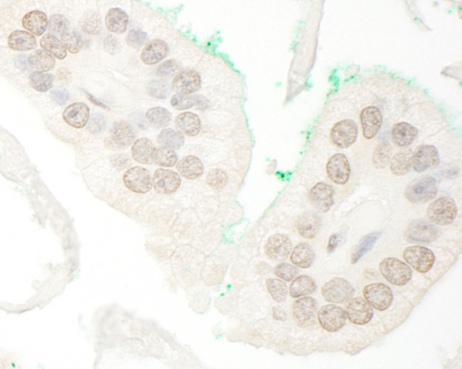 ARA70 Antibody in Immunohistochemistry (Paraffin) (IHC (P))