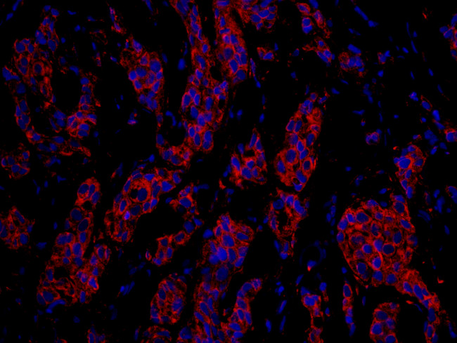 CKAP4 Antibody in Immunohistochemistry (Paraffin) (IHC (P))
