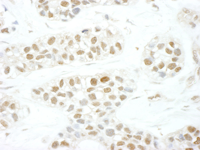 TFIIS Antibody in Immunohistochemistry (Paraffin) (IHC (P))