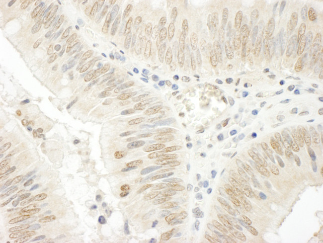 NOPP140 Antibody in Immunohistochemistry (Paraffin) (IHC (P))