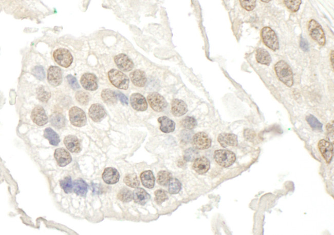 BRD7 Antibody in Immunohistochemistry (Paraffin) (IHC (P))