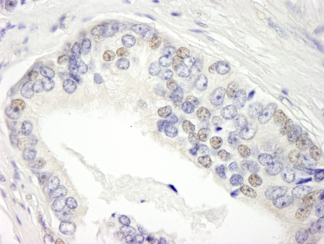 BRD3 Antibody in Immunohistochemistry (Paraffin) (IHC (P))