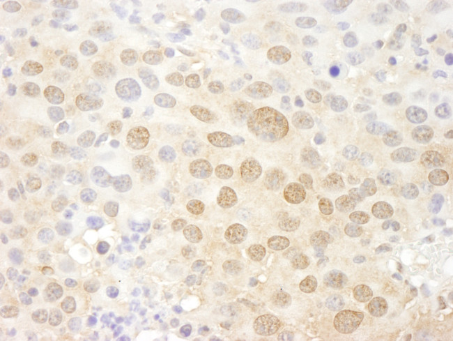 Pc2 Antibody in Immunohistochemistry (Paraffin) (IHC (P))