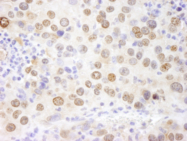 HMGN1 Antibody in Immunohistochemistry (Paraffin) (IHC (P))