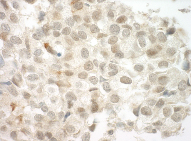 PRCC Antibody in Immunohistochemistry (Paraffin) (IHC (P))