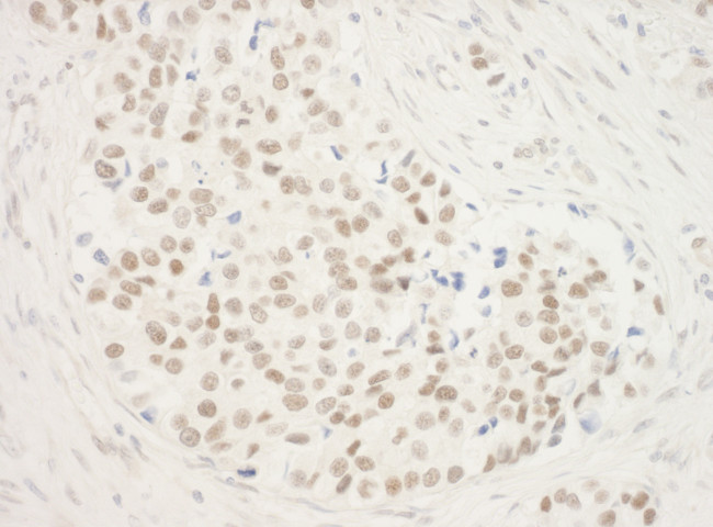 ZNF768 Antibody in Immunohistochemistry (Paraffin) (IHC (P))