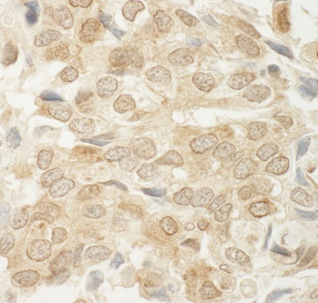 MED15 Antibody in Immunohistochemistry (Paraffin) (IHC (P))