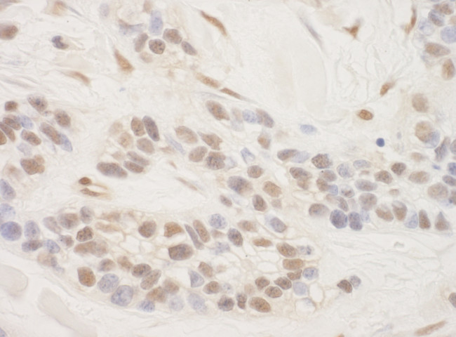 TORC3 Antibody in Immunohistochemistry (Paraffin) (IHC (P))