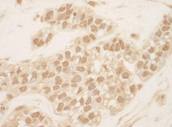 Cul2 Antibody in Immunohistochemistry (Paraffin) (IHC (P))