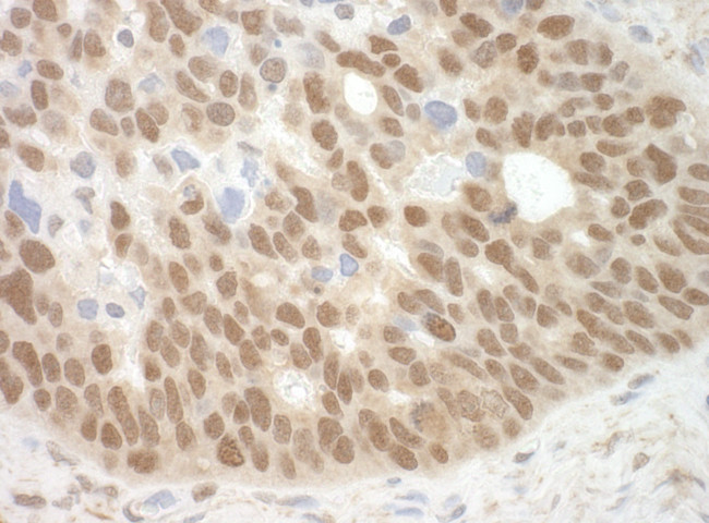MBD3 Antibody in Immunohistochemistry (Paraffin) (IHC (P))
