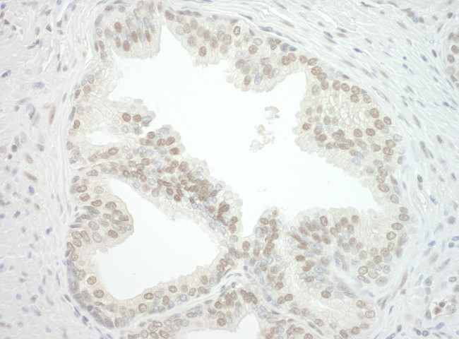 CBX7 Antibody in Immunohistochemistry (Paraffin) (IHC (P))