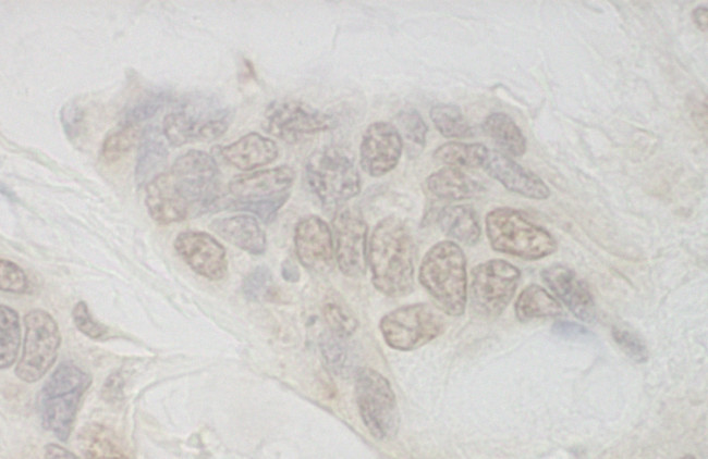 IBP160 Antibody in Immunohistochemistry (Paraffin) (IHC (P))