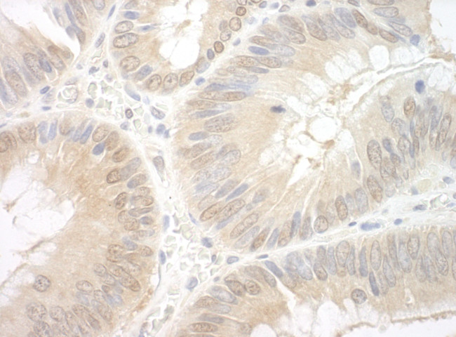 EAF2 Antibody in Immunohistochemistry (Paraffin) (IHC (P))