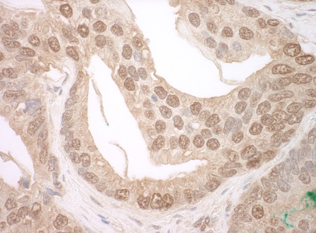 TFIP11 Antibody in Immunohistochemistry (Paraffin) (IHC (P))