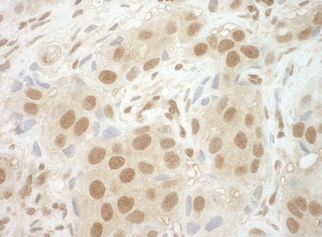 NCBP2 Antibody in Immunohistochemistry (Paraffin) (IHC (P))