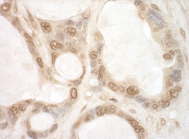 eIF2B5 Antibody in Immunohistochemistry (Paraffin) (IHC (P))