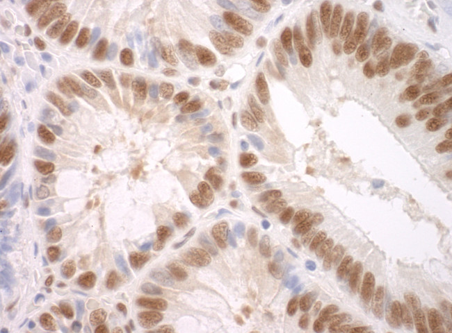 SF3A3 Antibody in Immunohistochemistry (Paraffin) (IHC (P))