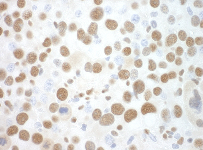 SF3B3 Antibody in Immunohistochemistry (Paraffin) (IHC (P))