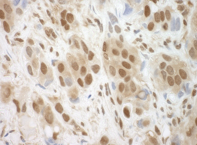 BRCC36 Antibody in Immunohistochemistry (Paraffin) (IHC (P))