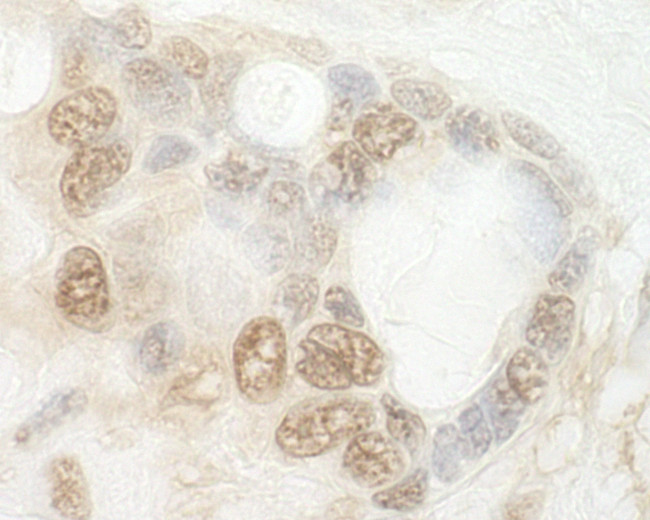 CNOT2 Antibody in Immunohistochemistry (Paraffin) (IHC (P))