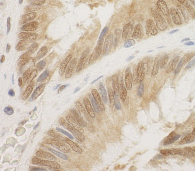 CDC6 Antibody in Immunohistochemistry (Paraffin) (IHC (P))