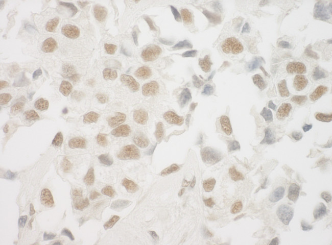 Ku70 Antibody in Immunohistochemistry (Paraffin) (IHC (P))