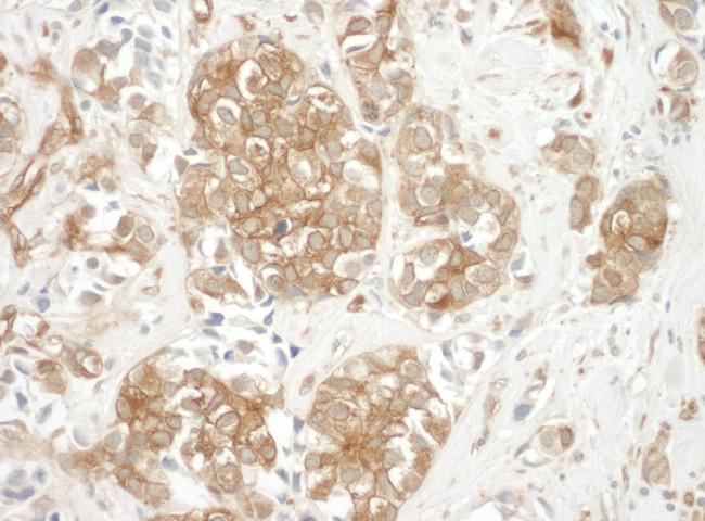 Cortactin Antibody in Immunohistochemistry (Paraffin) (IHC (P))