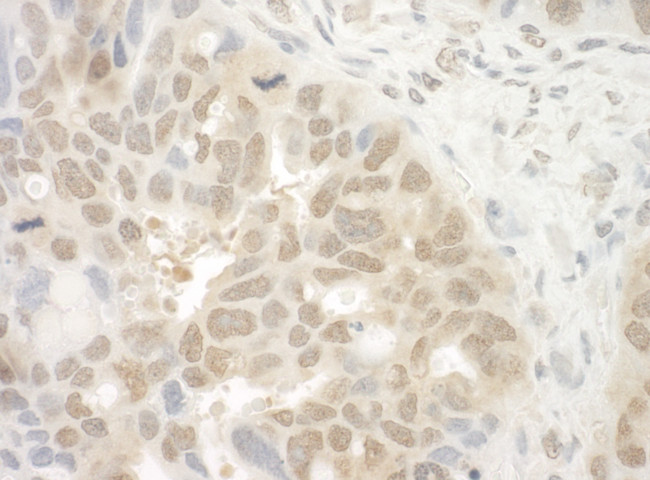 EYA4 Antibody in Immunohistochemistry (Paraffin) (IHC (P))