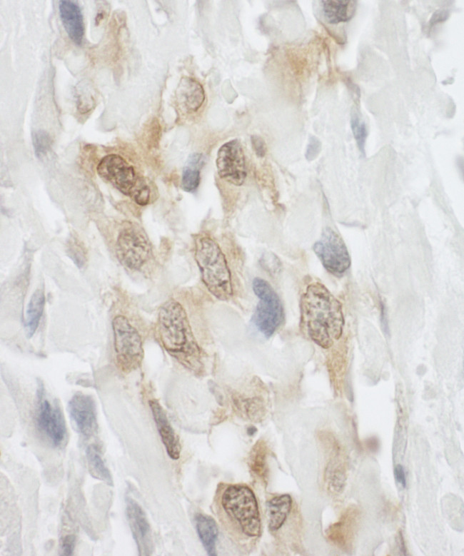 LPP Antibody in Immunohistochemistry (Paraffin) (IHC (P))