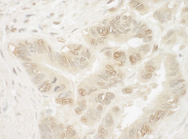 Pygo1 Antibody in Immunohistochemistry (Paraffin) (IHC (P))