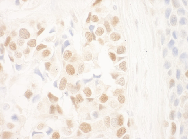 NRIP Antibody in Immunohistochemistry (Paraffin) (IHC (P))
